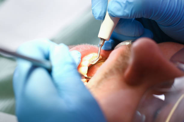 Professional Emergency Dental Service in VA