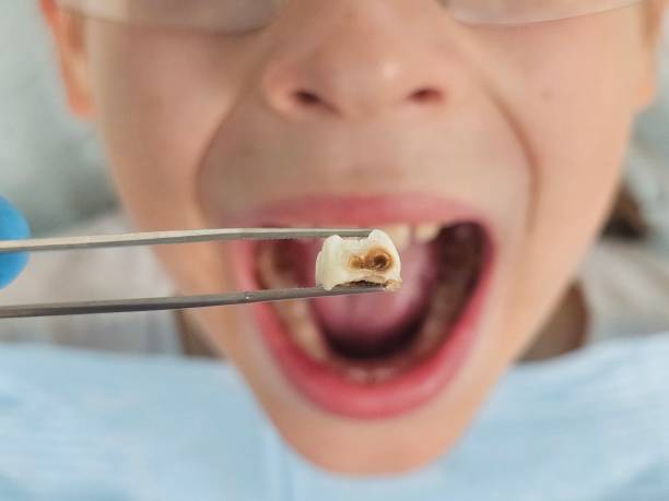 Best Emergency Pediatric Dental Care in Dooms, VA